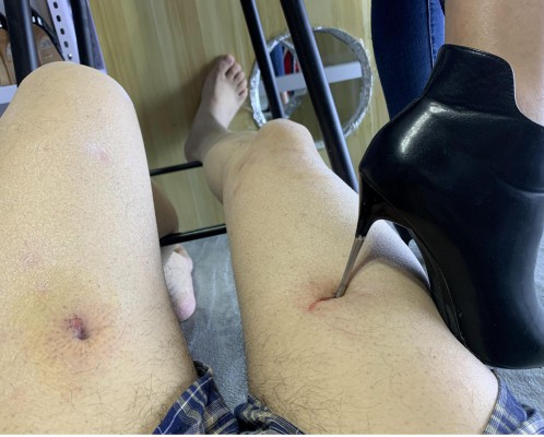 图片[9]_超细打磨的鞋跟大腿钻血洞，10和12厘米高跟跺肚子 YC-211012-3_绳缚吧