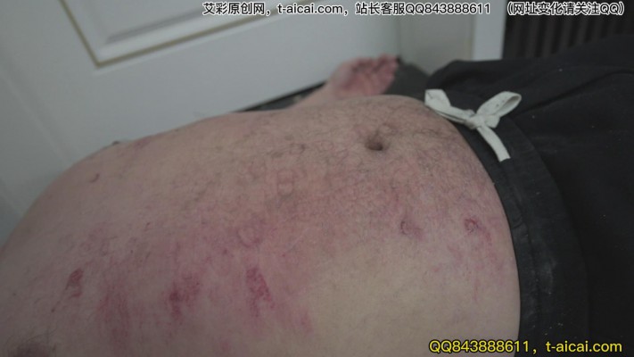 兔子牙 超模之下体无完肤 旧伤新伤持续腐烂 YC-230303-2_绳缚吧