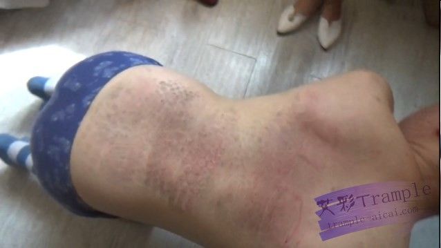 图片[5]_婷婷小林扇打_绳缚吧