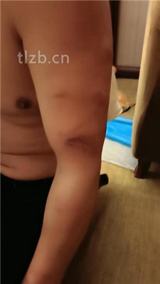 图片[4]_【馨雅】捆绑口球塞嘴重度虐打_绳缚吧